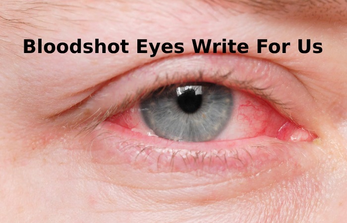 Bloodshot Eyes Write For Us