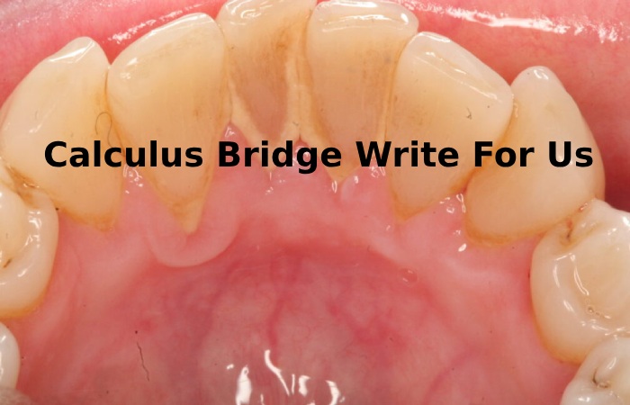 Calculus Bridge Write For Us