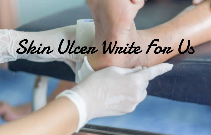 Skin Ulcer Write For Us